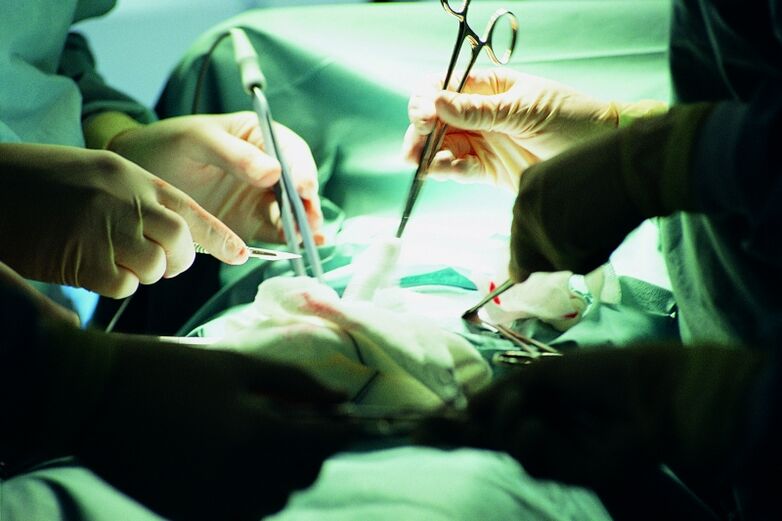 chirurgické zvýšení tloušťky penisu