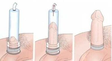 pumpa na zvětšení penisu